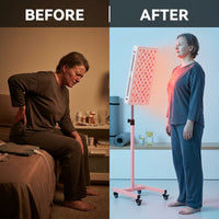 Red Light Therapy Device with Stand - Moving Pro Series Professional Edition — Before & After